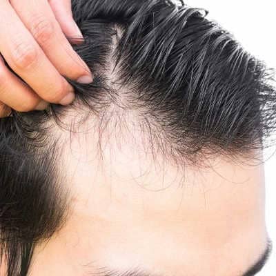 Причины выпадения волос