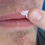 Простуда на верхней губе лечение в домашних условиях thumbnail